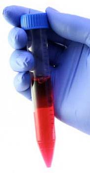 Пробирка коническая 10 мл, 17х121 мм, п/п, нестерил., с град-кой., с винт.,крышкой, M.Med, 100 шт/упак Пробирка коническая 10 мл, 17х121 мм, п/п, нестерил., с град-кой., с винт.,крышкой, M.Med, 100 шт/упак